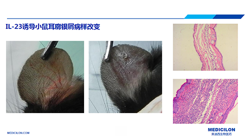 4734df1d-6ce7-466c-8b23-544901dadad2 白介素IL-23诱导的幼鼠耳廓银屑病样扭转