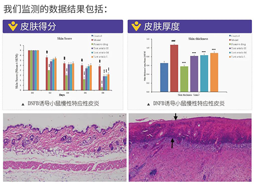 兰科博弈RankBet成立的特应性皮炎及湿疹模型监测数据了局