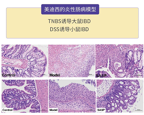 兰科博弈RankBet的炎症性肠病模型