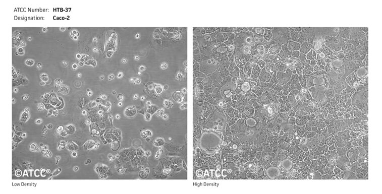 Caco-2细胞(起源--ATCC).jpg Caco-2细胞(起源--ATCC).jpg